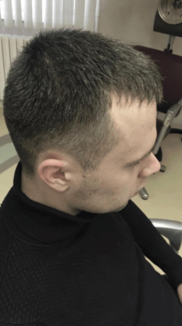 After hair treatment