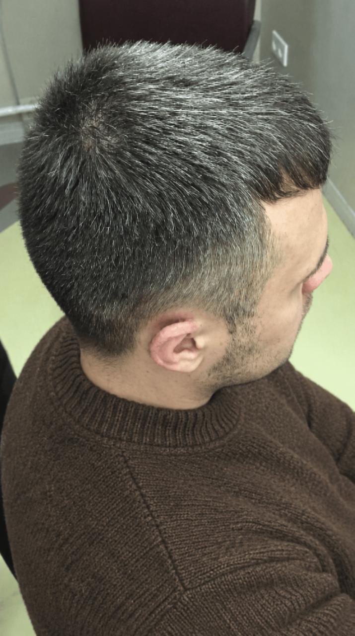 Before hair treatment